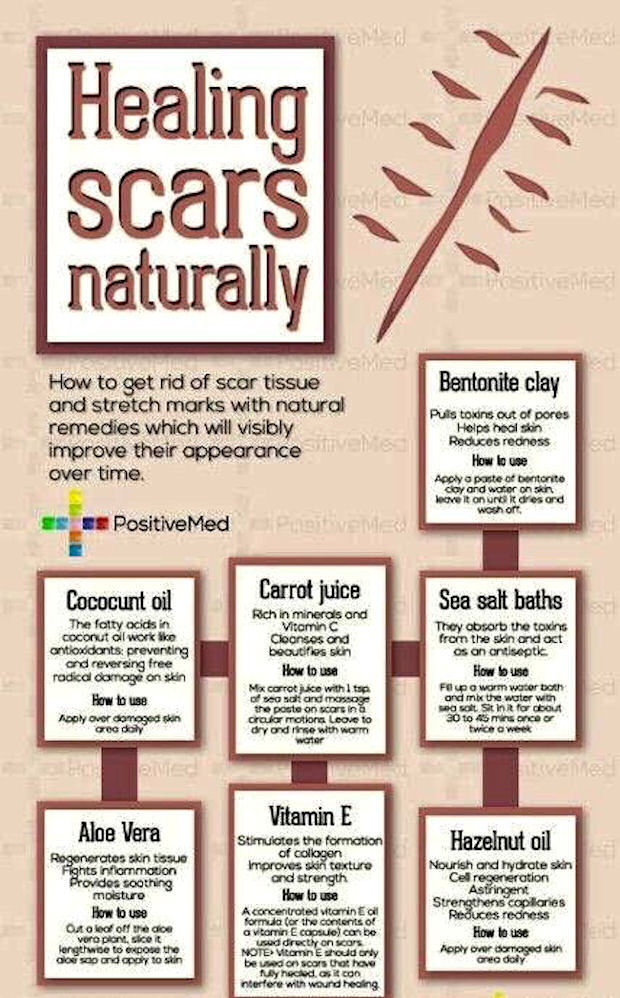 How To Heal Scars Naturally Pictures, Photos, and Images for Facebook
