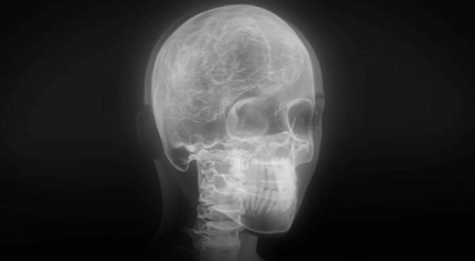 X-Ray Skeleton X-Ray Skeleton