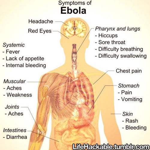 symptoms of ebola symptoms of ebola
