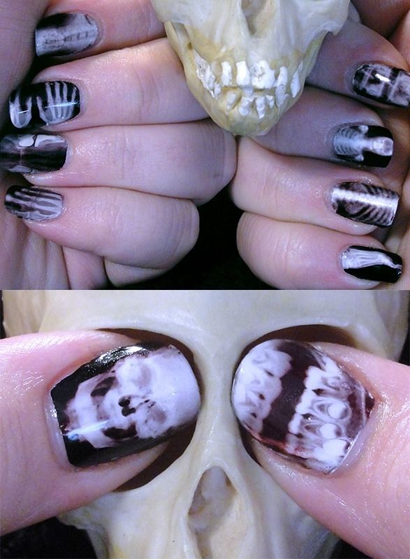 X Ray nails