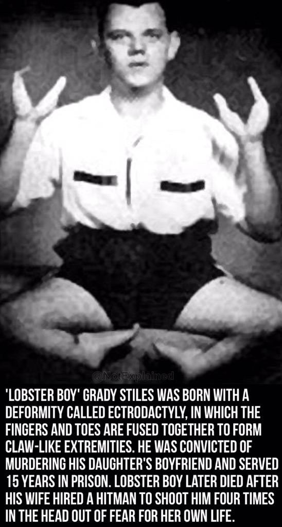 Lobster Boy Pictures, Photos, and Images for Facebook, Tumblr