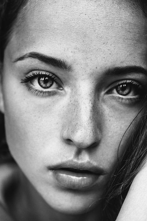 Beautiful freckled girl