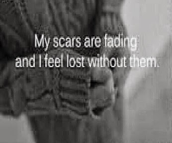 Scars