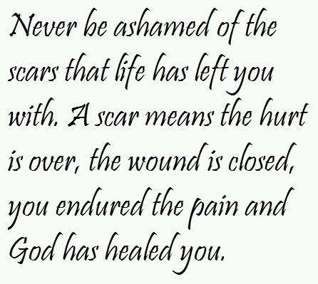 never be ashamed of scars