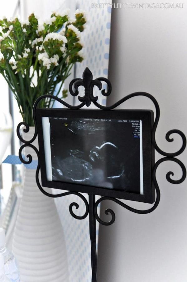 Ultrasound image idea
