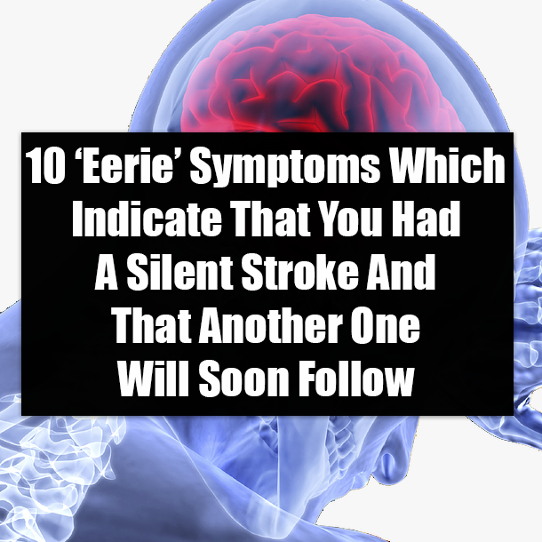 10 ‘Eerie’ Symptoms Which Indicate That You Had A Silent Stroke And That Another One Will Soon Follow