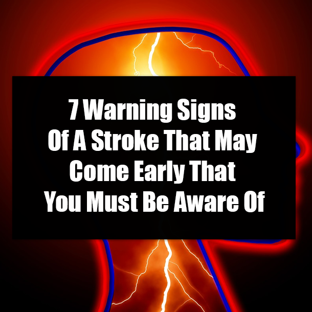 7 Warning Signs Of A Stroke That May Come Early That You Must Be Aware Of
