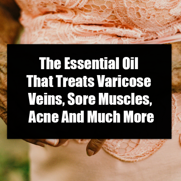 The Essential Oil That Treats Varicose Veins, Sore Muscles, Acne And Much More
