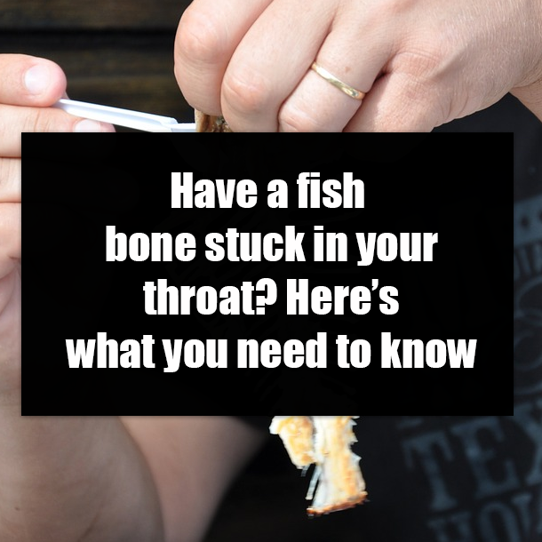 Have a fish bone stuck in your throat? Here’s what you need to know