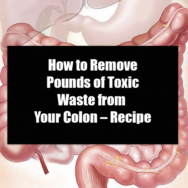 How to Remove Pounds of Toxic Waste from Your Colon – Recipe