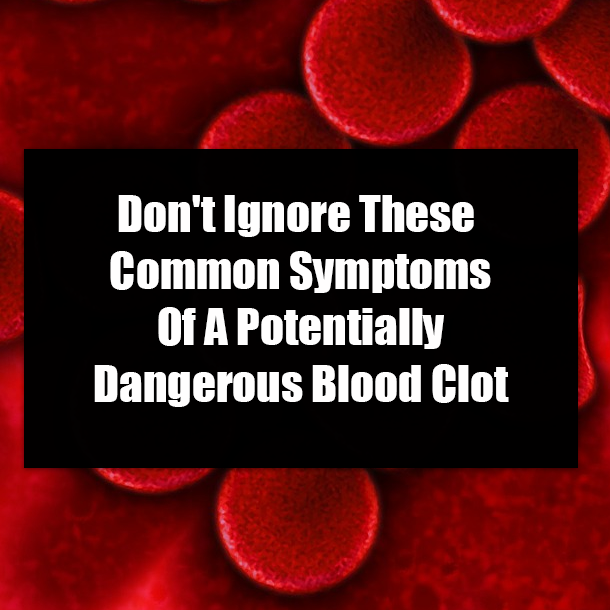 Don't Ignore These Common Symptoms Of A Potentially Dangerous Blood Clot