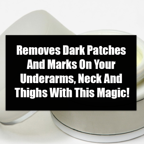 Removes Dark Patches And Marks On Your Underarms, Neck And Thighs With This Magic!