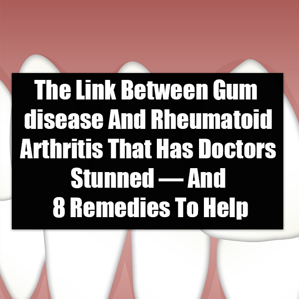 The Link Between Gum disease And Rheumatoid Arthritis That Has Doctors Stunned — And 8 Remedies To Help