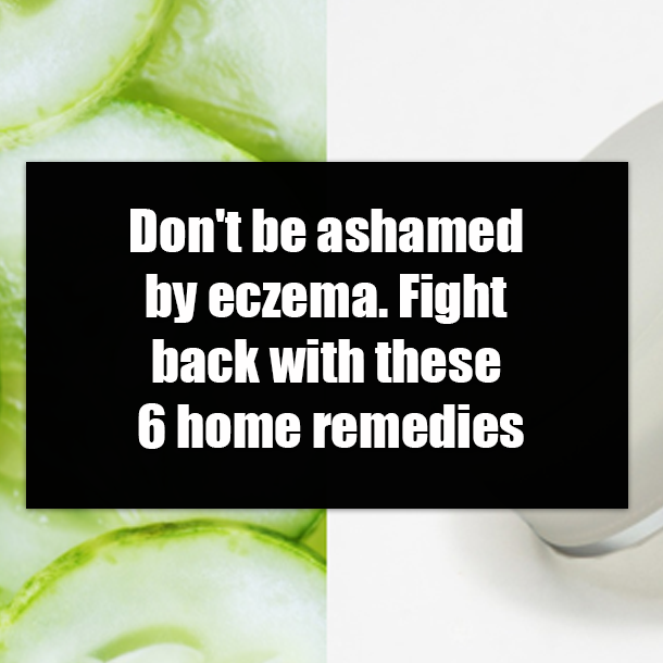 Don't be ashamed by eczema. Fight back with these 6 home remedies