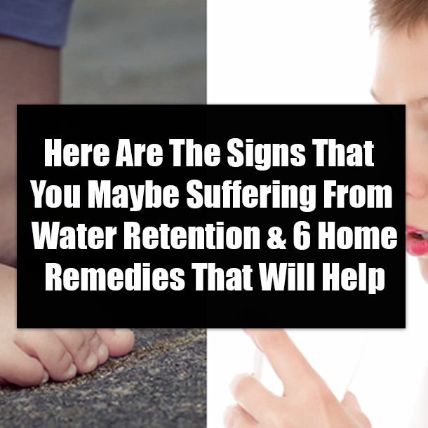 Here Are The Signs That You Maybe Suffering From Water Retention & 6 Home Remedies That Will Help
