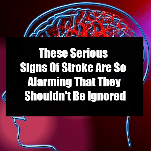 These Serious Signs Of Stroke Are So Alarming That They Shouldn't Be Ignored