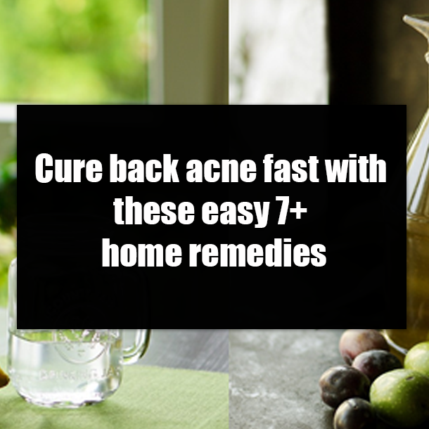 Cure back acne fast with these easy 7+ home remedies