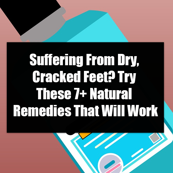 Suffering From Dry, Cracked Feet? Try These 7+ Natural Remedies That Will Work