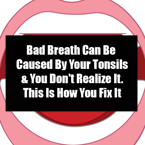 Bad Breath Can Be Caused By Your Tonsils & You Don't Realize It. This Is How You Fix It