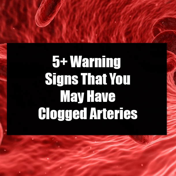 5+ Warning Signs That You May Have Clogged Arteries
