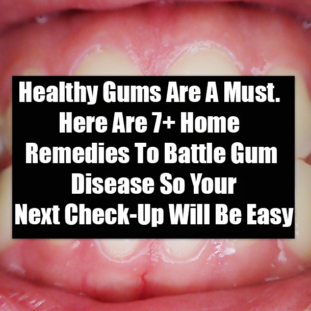 Healthy Gums Are A Must. Here Are 7+ Home Remedies To Battle Gum Disease So Your Next Check-Up Will Be Easy