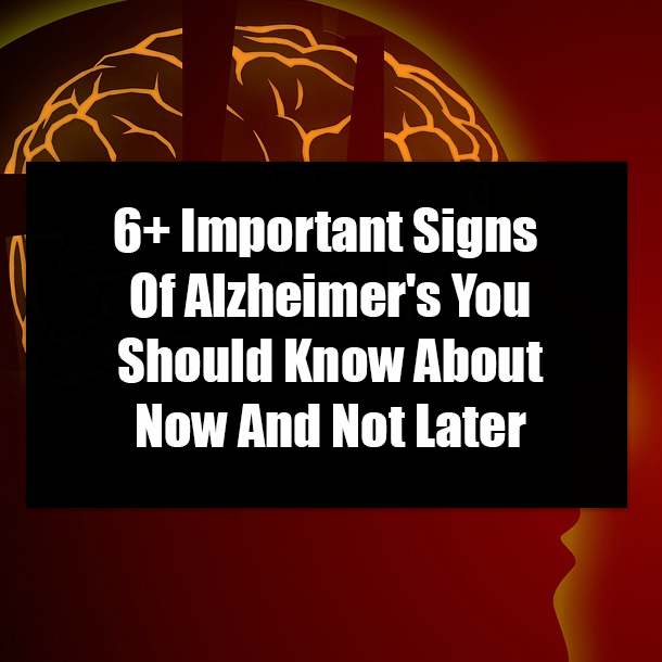 6+ Important Signs Of Alzheimer's You Should Know About Now And Not Later
