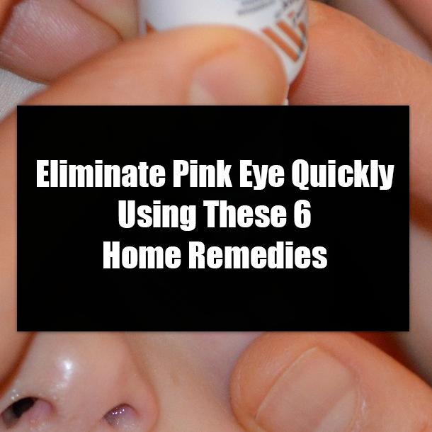 Eliminate Pink Eye Quickly Using These 6 Home Remedies