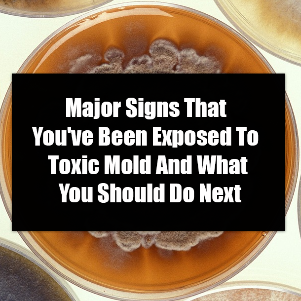 Major Signs That You've Been Exposed To Toxic Mold And What You Should Do Next