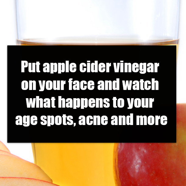 Put apple cider vinegar on your face and watch what happens to your age spots, acne and more