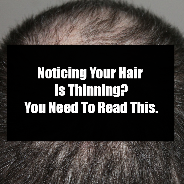 Noticing Your Hair Is Thinning? You Need To Read This.