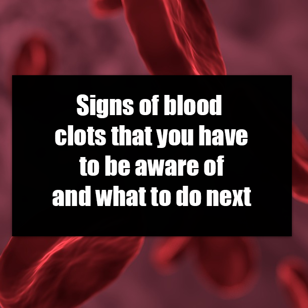 Signs of blood clots that you have to be aware of and what to do next