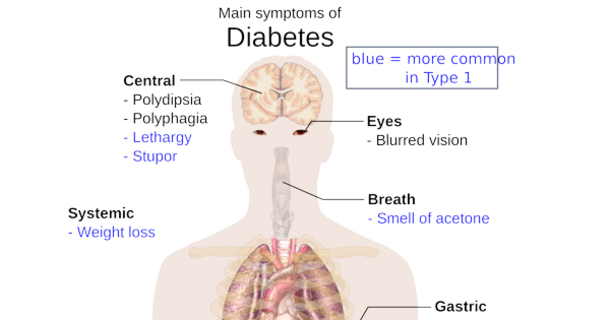 ​Here Are 14 Ways That You Could Have High Blood Sugar - picture 2