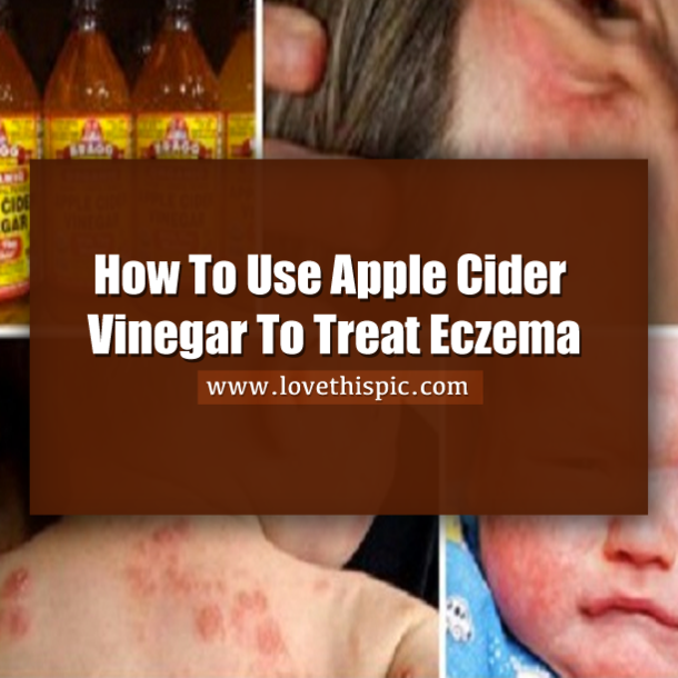 ​How To Use Apple Cider Vinegar To Treat Eczema