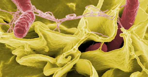 10 signs you have mold illness and what you need to know - picture 2