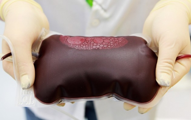 10 Things You Should Know About Your Blood Type - picture 11