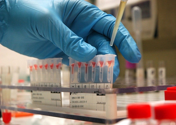 10 Things You Should Know About Your Blood Type - picture 6