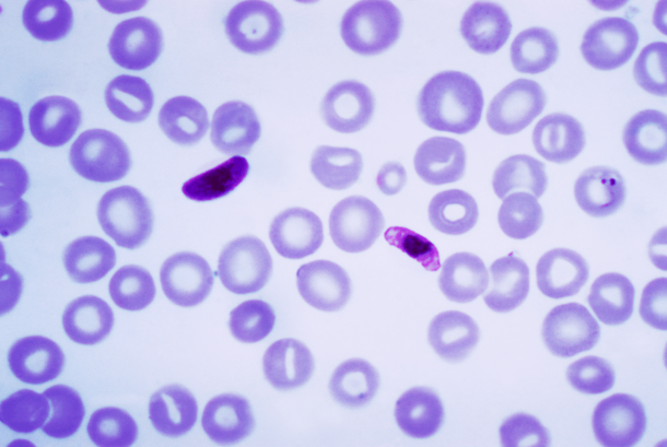 10 Things You Should Know About Your Blood Type - picture 7