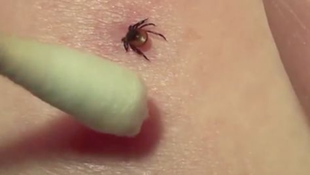 13 Clever Ways To Use Listerine That All Woman Should Be Aware Of - picture 12