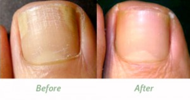 14 Surprising Ways You Can Use Vaporizing Rub - picture 3
