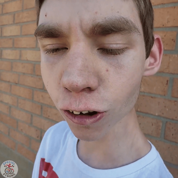 17-Year-Old Special needs kid walks for the first time after spending 8 years in wheelchair - picture 2