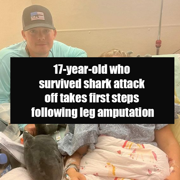 17-year-old who survived shark attack off takes first steps following leg amputation