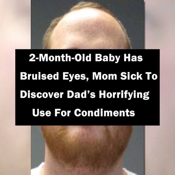 2-Month-Old Baby Has Bruised Eyes, Mom Sickened To Discover Dad’s Horrifying Use For Condiments