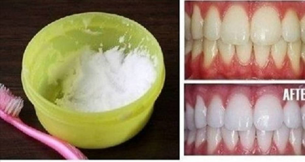 How To Have White Teeth At Home In Just 3 Minutes - picture 6