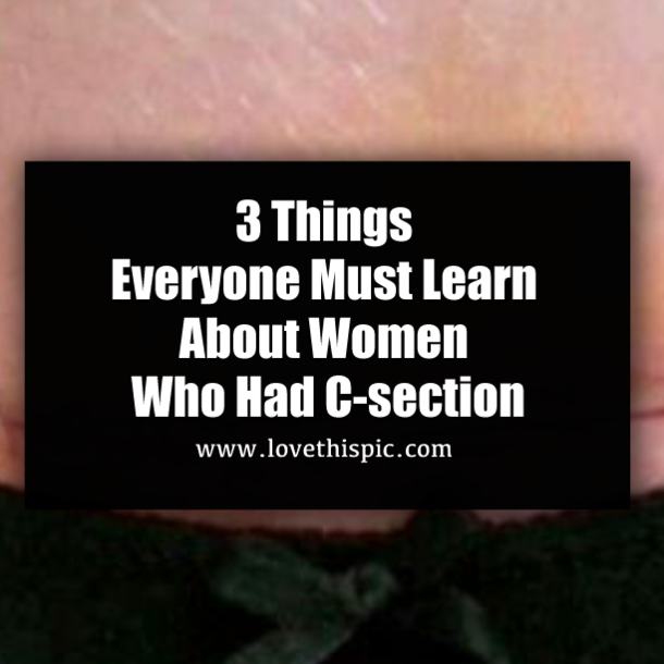 3 Things Everyone Must Learn About Women Who Had C-section