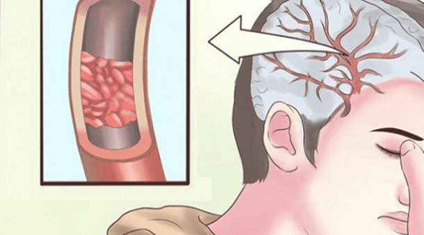 32 Signs You Immediately Need More Magnesium (and how to get it) - picture 2
