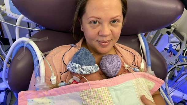 39-Year Old Mother is told she’s having a miscarriage but doesn’t believe doctors: ‘I could feel the babies moving’ - picture 3