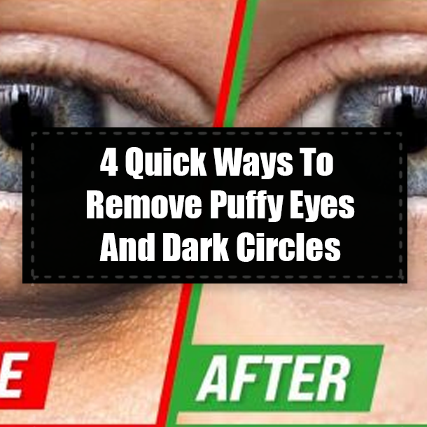 4 Quick Ways To Remove Puffy Eyes And Dark Circles