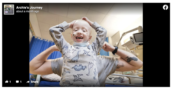 4-year-old boy combats the virus as he undergoes chemotherapy, survives the infection despite cancer - picture 5