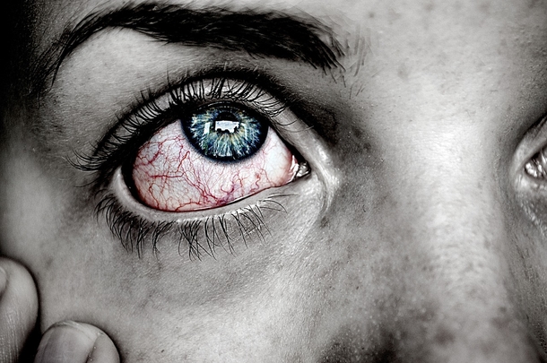 40 Year Old Man Is Diagnosed With Eye Cancer Because He Did This Every Night... - picture 5