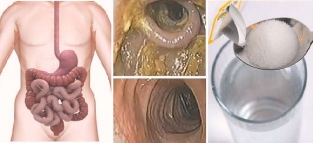 48-Hours Weekend Liver, Colon And Kidney Detox That Will Remove All Toxins And Fat From Your Body - picture 2